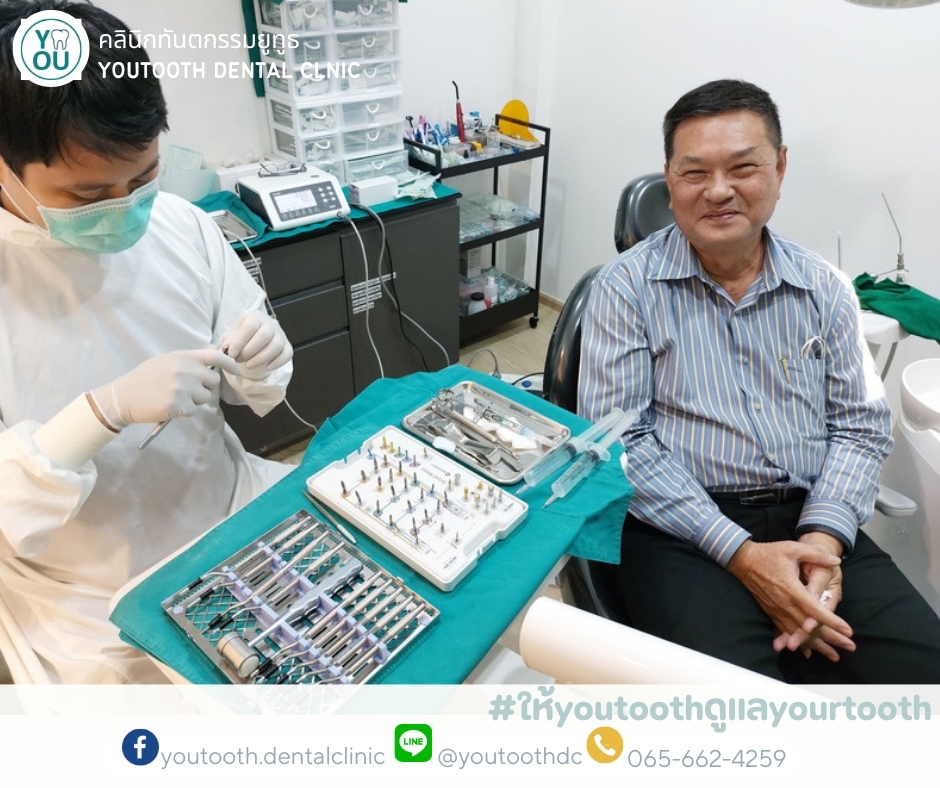 รีวิวรากฟันเทียม