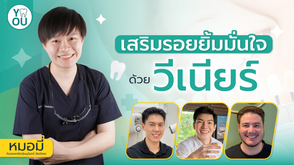 วีเนียร์ราคา