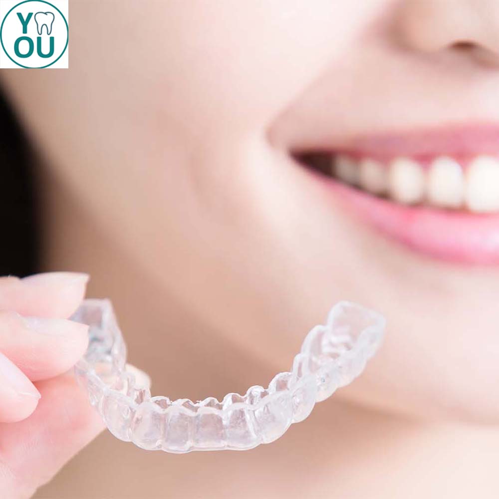 จัดฟันใส Invisalign VS จัดฟันแบบทั่วไป ต่างกันอย่างไร เทียบข้อดี-ข้อเสีย