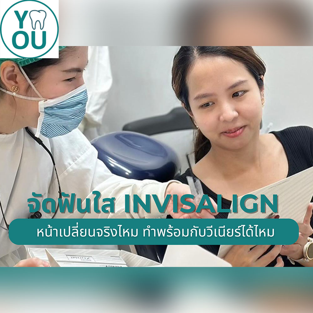 จัดฟันใส  Invisalign หน้าเปลี่ยนจริงไหม ทำพร้อมกับวีเนียร์ได้ไหม