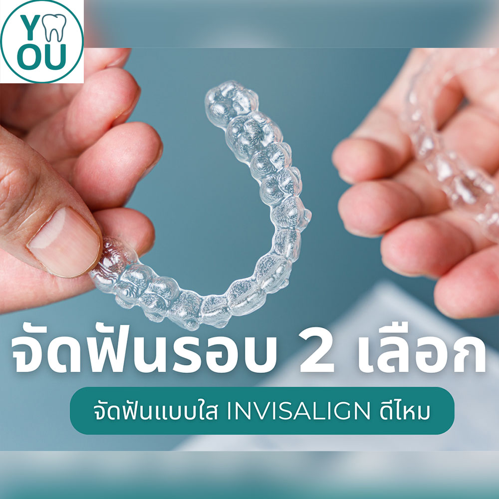 จัดฟันรอบ 2 เลือกจัดฟันแบบใส Invisalign ดีไหม