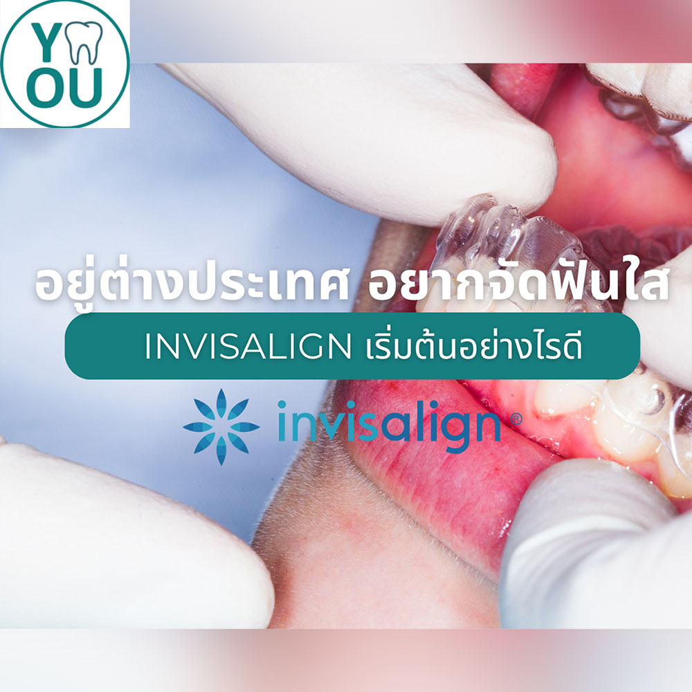 อยู่ต่างประเทศ อยากจัดฟันใส Invisalign เริ่มต้นอย่างไรดี