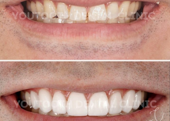 LINE_ALBUM_220831_36